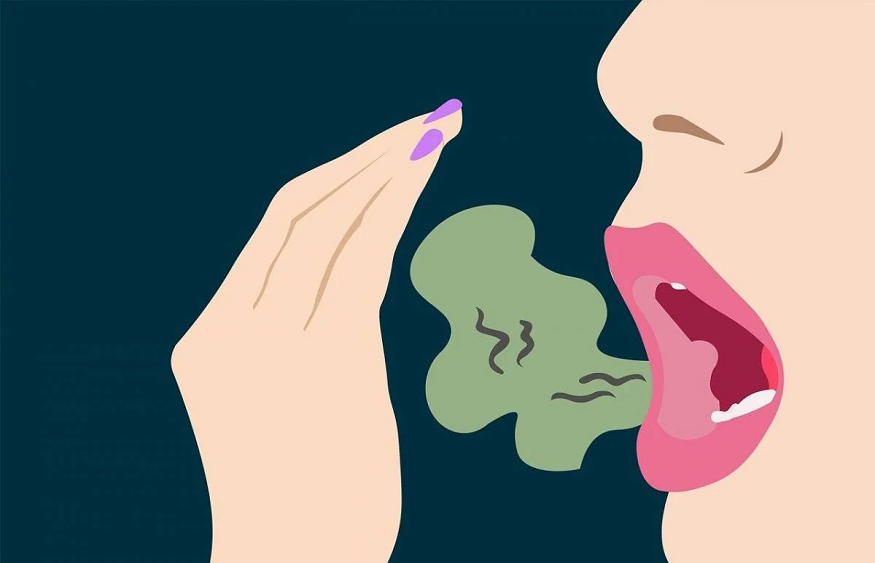 Can Halitosis Be Cured Permanently?