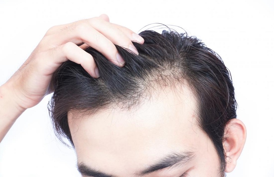 From Pricing to Payment Plans: The Costs of Hair Transplantation