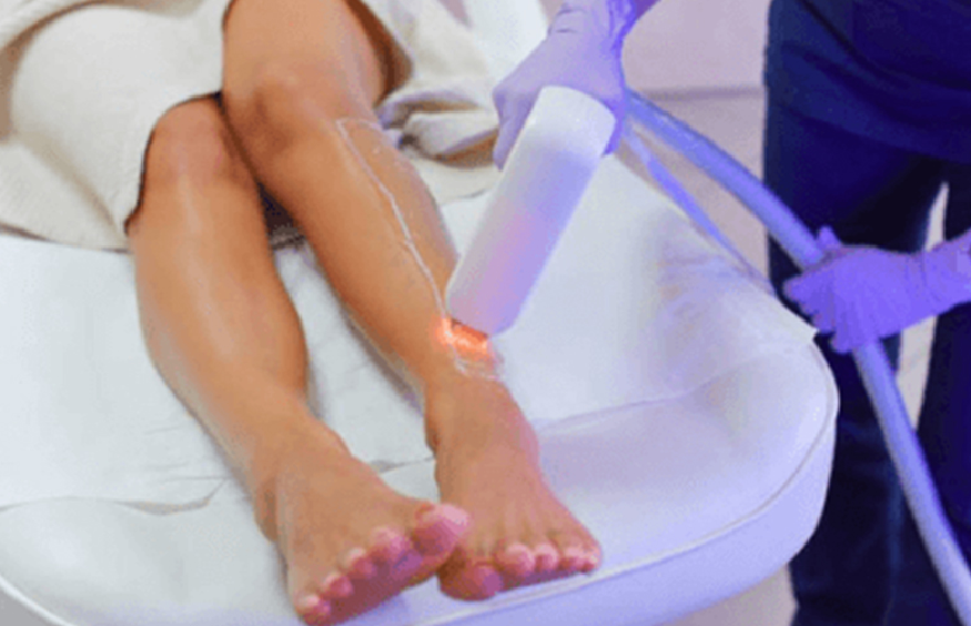 How SHR Hair Removal Works: Science and Benefits Explained